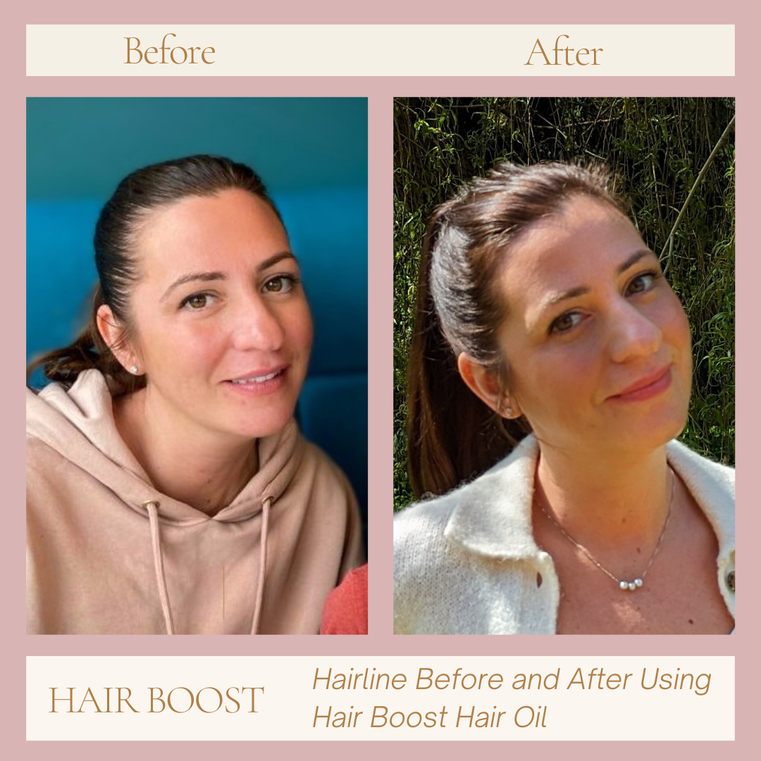 hair boost hair oil for thickening hair before and after pictures